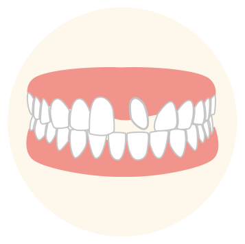 Tooth Position and/or Rotation