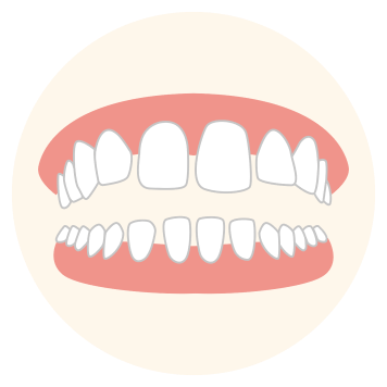 Gapped Teeth